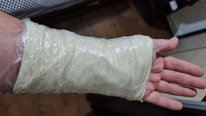 Cataplasmă cu huște și frunze de varză, foto 8